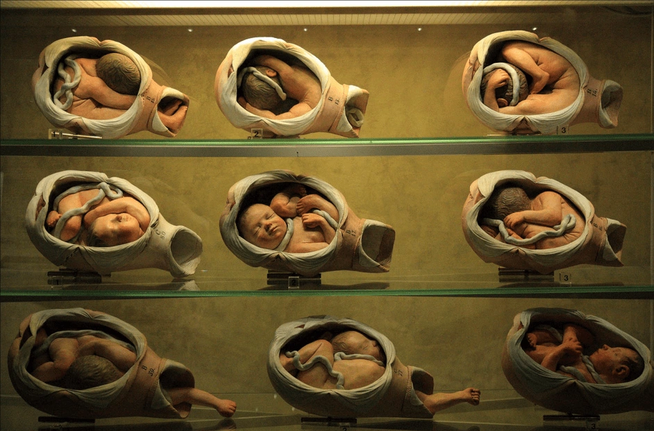 Cere anatomiche di feti dalla collezione del Museo delle cere anatomiche Luigi Cattaneo a Bologna.